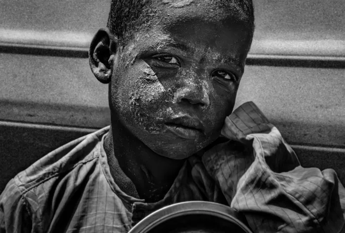 Garmendia, Inazio Joxe: Bambino che chiede aiuto nelle strade del Congo