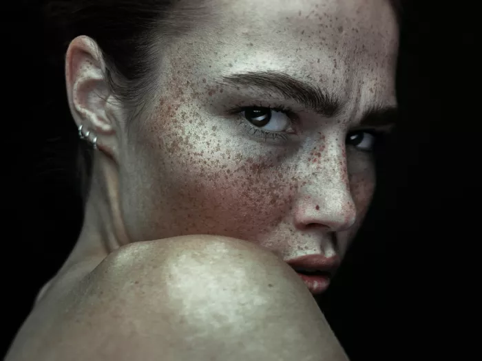 Krystynek, Martin: Freckles beauty