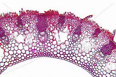 Neznámý: Rostlinná tkáň infikovaná houbou