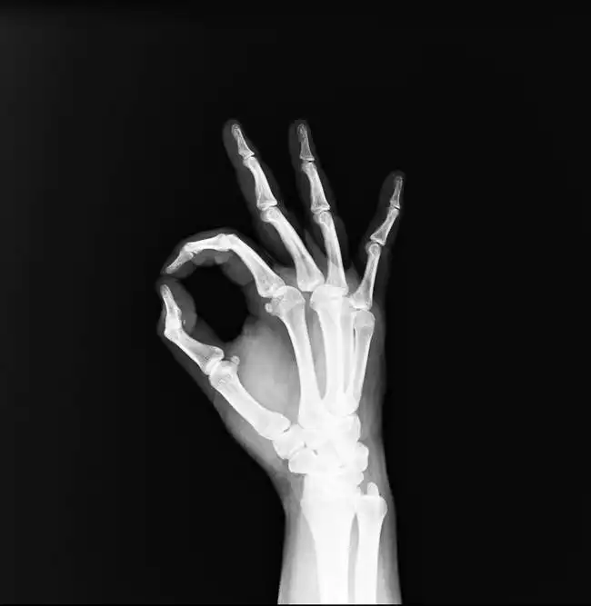 Neznámý: Lidská ruka