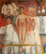 Kahlo, Frida: Frida a císařský řez